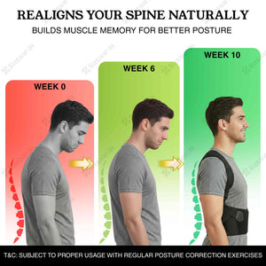 Illustration showing a person's posture improvement over time with a brace, labeled 'Week 0', 'Week 6', and 'Week 10'.